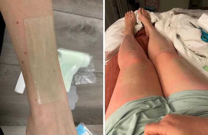 Wrap Yourself In The Healing Power Of Aloe Vera With This <a Style="Display:inline;" Href=" Https://Www.amazon.com/Dp/B0bvdcnznr?ascsubtag=7696255%2c41%2c51%2cd%2c0%2c0%2c0%2c900%3a2%3b974%3a3%3b1125%3a1%3b1338%3a1%2c47866521%2c0%2c0%2c0&btn_ref=srctok-Ab5c52f62b27f81e&linkcode=ll1&tag=bprhinoceros-20&linkid=d9c07ece5b6824b539e19fea614e83c9&language=en_us&ref_=as_li_ss_tl" Target="_blank"><span Style="Font: Inherit; Color: #d74b1f;"> Aloe Wrap</Span> - The Perfect Solution For Sunburned Skin