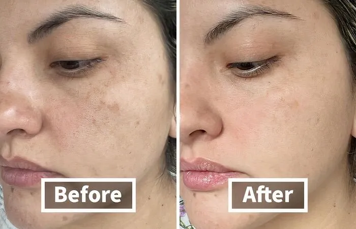Before: Puffy, Sleep-Deprived Eyes Begging For A Caffeine Boost <br><br> After:  <a Style="Display:inline;" Href="Https://Www.amazon.com/Dp/B091njq29p?ascsubtag=7700644%2c11%2c31%2cd%2c0%2c0%2cbf-Web-Hf%2c900%3a2%3b974%3a3%3b1125%3a1%3b1338%3a1%2c48145344%2c0%2c0%2c0&btn_ref=srctok-De1ffaba10cce7b6&linkcode=ll1&tag=bpbobcat-20&linkid=536f47dee3767bb6747b84cd4c9f2db6&language=en_us&ref_=as_li_ss_tl" Target="_blank"><span Style="Font: Inherit; Color: #d74b1f;"> Yerba Mate Wake Up Eye Gel</Span> Revitalizes Your Under-Eye Area, Making You Look Bright-Eyed And Bushy-Tailed (Even If You're Running On Fumes)