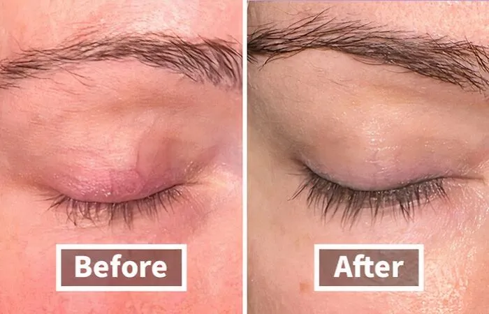 Before: Short, Sparse Lashes That Barely Make A Statement <br><br> After: <a Style="Display:inline;" Href="Https://Www.amazon.com/Grande-Cosmetics-Grandelash-Md-Enhancing-Serum/Dp/B082wztjv5?pd_rd_w=y3y5x&content-ID=amzn1.sym.31346ea4-6dbc-4ac4-B4f3-Cbf5f8cab4b9&pf_rd_p=31346ea4-6dbc-4ac4-B4f3-Cbf5f8cab4b9&pf_rd_r=q2k5h04akz15bs3wajax&pd_rd_wg=xj2rm&pd_rd_r=1d9f0f82-88b7-4cf7-98a3-9cd356bd976e&pd_rd_i=b082wztjv5&psc=1&linkcode=ll1&tag=bpbobcat-20&linkid=1bf3ce013b58c8ba995ede31d73ffca6&language=en_us&ref_=as_li_ss_tl" Target="_blank"><span Style="Font: Inherit; Color: #d74b1f;"> Lash Enhancing Serum</Span> Works Its Magic, Transforming Your Lashes Into Long, Luscious Flutterers That'll Have Everyone Batting An Eye