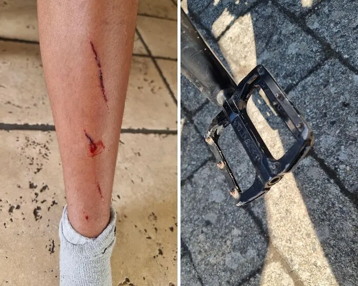 "Wear your shin guards mountainbikers" - <span Style="Font:inherit;color:#808080"> Ok-Perspective1524</Span>
