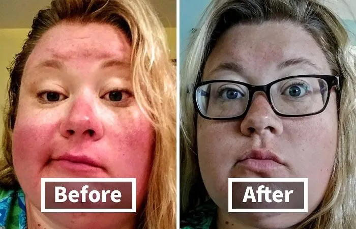 Dark Circles? Redness? Uneven Skin Tone? This   <a Style="Display:inline;" Href="Https://Www.amazon.com/Stila-Corrector-Brightening-Moisturize-Oil-Free/Dp/B003w5gl5i?ie=utf8&linkcode=ll1&tag=bpfish-20&linkid=c7fad6521d7aa96f72fb93dc90287c24&language=en_us&ref_=as_li_ss_tl " Target="_blank"><span Style="Font: Inherit; Color: #d74b1f;"> Color Corrector & Brightening Primer</Span> Is Like A Magic Wand For Your Face, Erasing Imperfections And Creating A Flawless Canvas