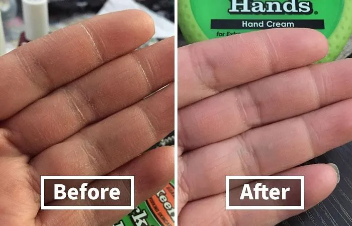 Your Hands Are So Dry, They Could Start A Dust Storm. Time To Bring In The Moisture Cavalry With   <a Style="Display:inline;" Href="Https://Www.amazon.com/Okeeffes-Working-Hands-Cream-Ounce/Dp/B00121uvu0?ie=utf8&linkcode=ll1&tag=bpfish-20&linkid=30dc14e54d4087f0e0e7998b94b5e66c&language=en_us&ref_=as_li_ss_tl " Target="_blank"><span Style="Font: Inherit; Color: #d74b1f;"> Hand Cream For Extra Dry Hands</Span>