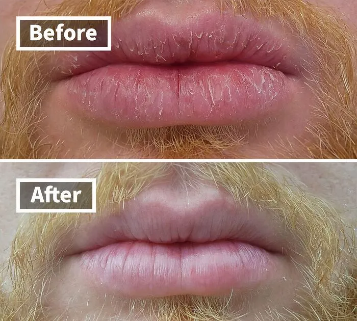 Pucker Up For Smoother Mornings!    <a Style="Display:inline;" Href="Https://Www.amazon.com/Okeeffes-Repair-Night-Treatment-Ounce/Dp/B07qj26dt1?ie=utf8&linkcode=ll1&tag=bpbuffalo-20&linkid=32eca38f1210da3bfbe313d2c90025a4&language=en_us&ref_=as_li_ss_tl " Target="_blank"><span Style="Font: Inherit; Color: #d74b1f;"> Lip Repair Night Treatment Lip Balm</Span> Works Its Magic While You Sleep, So You Wake Up With A Kissable Pout