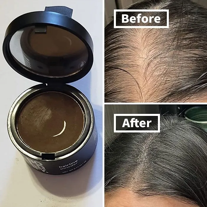 Bald Spots Got You Feeling Less Than Fabulous? <a Style="Display:inline;" Href="Https://Www.amazon.com/Hairline-Powder%ef%bc%8cinstantly-Conceals-Windproof-Sweatproof/Dp/B07mxrdnr2?ie=utf8&linkcode=ll1&tag=bpfish-20&linkid=e8614be709ca6358e77ba48d8ca4859a&language=en_us&ref_=as_li_ss_tl " Target="_blank"><span Style="Font: Inherit; Color: #d74b1f;"> Sevich Hairline Powder</Span> Will Create The Illusion Of Thicker, Fuller Hair In Seconds