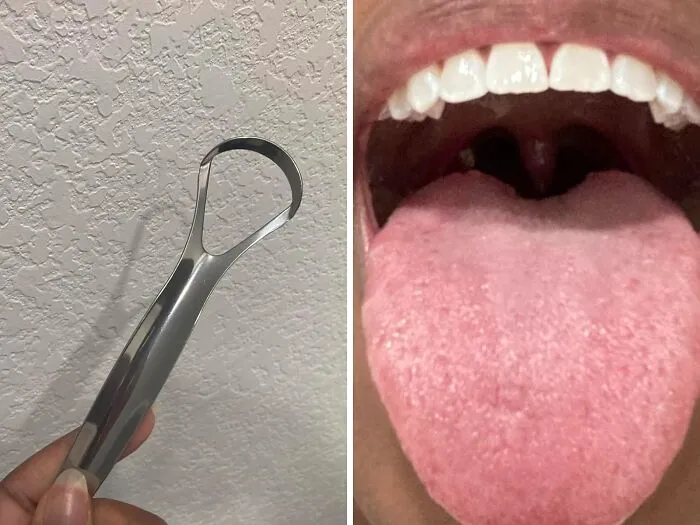 Your Tongue Will Be Feeling Fresher Than A Mint Julep After A Few Swipes With This   <a Style="Display:inline;" Href="Https://Www.amazon.com/Tongue-Scraper-Adults-Cleaner-Metal-Tounge-Scrapper/Dp/B08ntw58lx?ie=utf8&linkcode=ll1&tag=bpfish-20&linkid=6444c6cd5d9596f1eefde0eef41e6376&language=en_us&ref_=as_li_ss_tl " Target="_blank"><span Style="Font: Inherit; Color: #d74b1f;"> Tongue Scraper</Span>