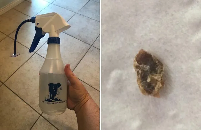 Q-Tips Are So Last Year.  Upgrade Your Ear Cleaning Game With This   <a Style="Display:inline;" Href="Https://Www.amazon.com/Elephant-Washer-Bottle-Doctor-Easy/Dp/B005m2b5p0?ie=utf8&linkcode=ll1&tag=bpfish-20&linkid=b6139cf4a2e8873f70eb54bdfe67730a&language=en_us&ref_=as_li_ss_tl " Target="_blank"><span Style="Font: Inherit; Color: #d74b1f;"> Doctor Easy Elephant Ear Washer</Span> And Say "Hello" To A Safe And Effective Way To Remove Earwax