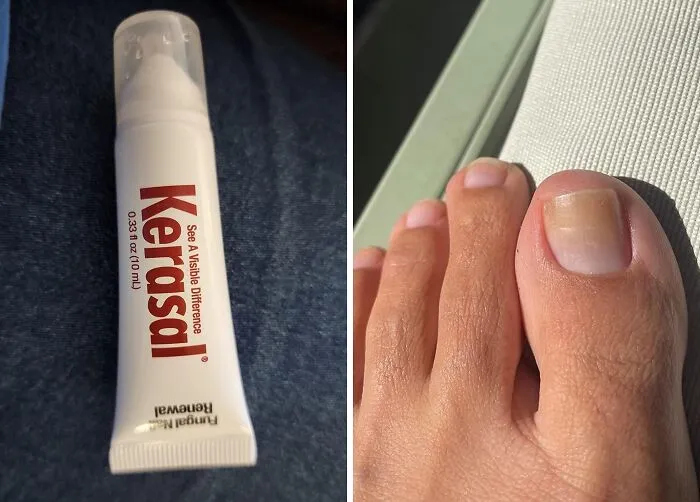 Don't Let Damaged Nails Cramp Your Style. Bring Back The Bling With   <a Style="Display:inline;" Href="Https://Www.amazon.com/Kerasal-Fungal-Nail-Renewal-Visible/Dp/B007adol28?ie=utf8&linkcode=ll1&tag=bpfish-20&linkid=dffddae8a253b9120c87c3b886c7ee6e&language=en_us&ref_=as_li_ss_tl " Target="_blank"><span Style="Font: Inherit; Color: #d74b1f;"> Kerasal Nail Renewal</Span> And Get Ready For Those Summer Sandals