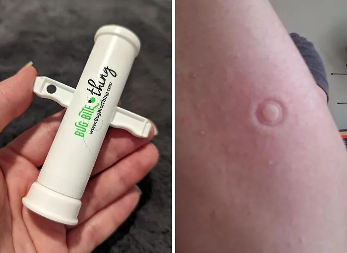 Itch, Begone! This <a Style="Display:inline;" Href=" Https://Www.amazon.com/Bug-Bite-Thing-Suction-Remover/Dp/B01576dwqu?ie=utf8&linkcode=ll1&tag=bpkiwi-20&linkid=934567685d4af25f3e232661b39e1bb8&language=en_us&ref_=as_li_ss_tl" Target="_blank">     <span Style="Font: Inherit; Color: #d74b1f;"> Bug Bite Relief Suction Tool</Span> Sucks The Sting Right Out Of Those Pesky Bites
