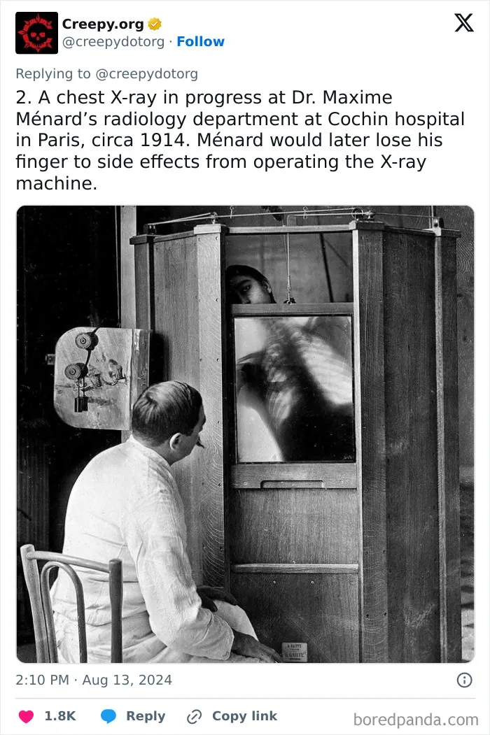 These 30 Bizarre Photos Show How Medical Treatments Were Carried Out Throughout History