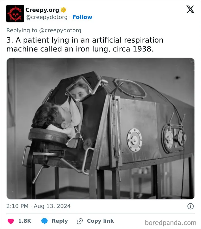These 30 Bizarre Photos Show How Medical Treatments Were Carried Out Throughout History