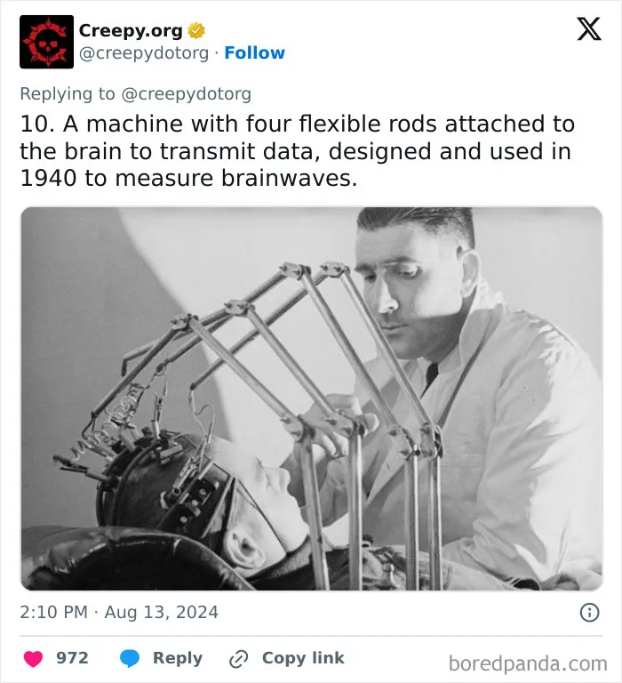 These 30 Bizarre Photos Show How Medical Treatments Were Carried Out Throughout History