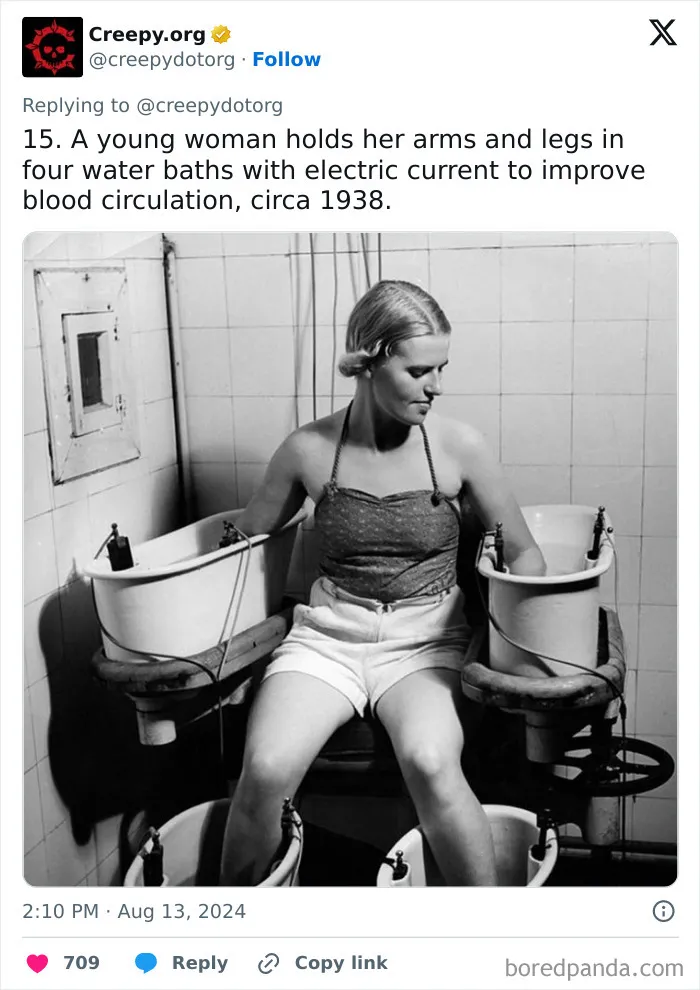 These 30 Bizarre Photos Show How Medical Treatments Were Carried Out Throughout History