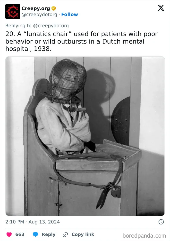 These 30 Bizarre Photos Show How Medical Treatments Were Carried Out Throughout History