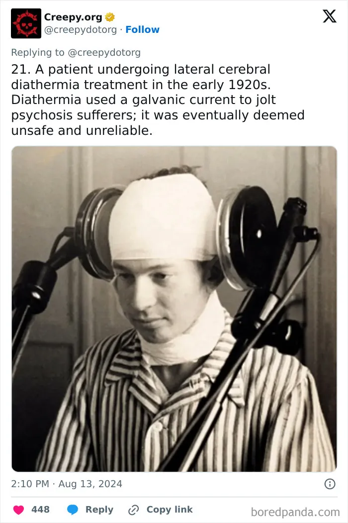 These 30 Bizarre Photos Show How Medical Treatments Were Carried Out Throughout History