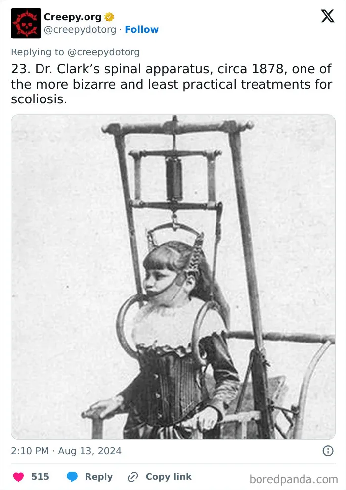 These 30 Bizarre Photos Show How Medical Treatments Were Carried Out Throughout History
