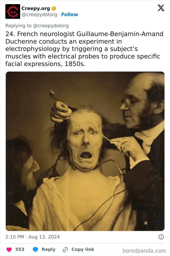 These 30 Bizarre Photos Show How Medical Treatments Were Carried Out Throughout History