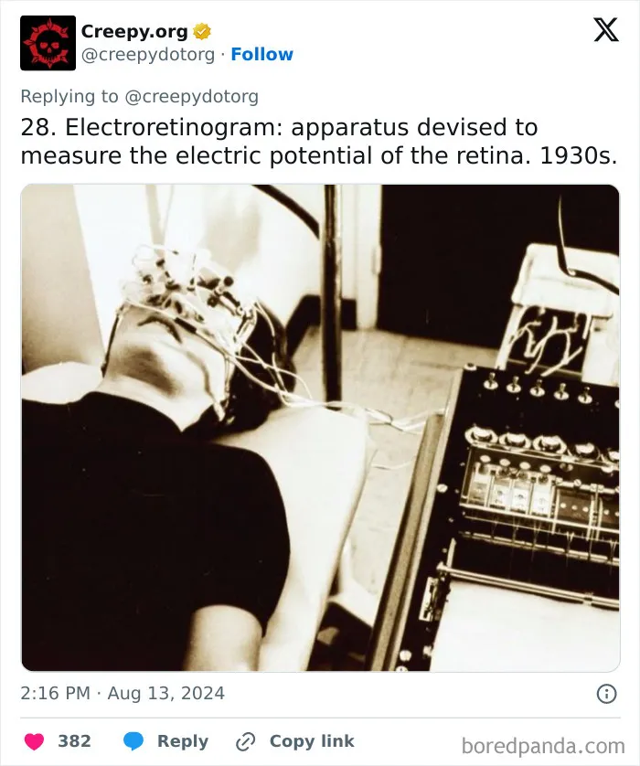 These 30 Bizarre Photos Show How Medical Treatments Were Carried Out Throughout History