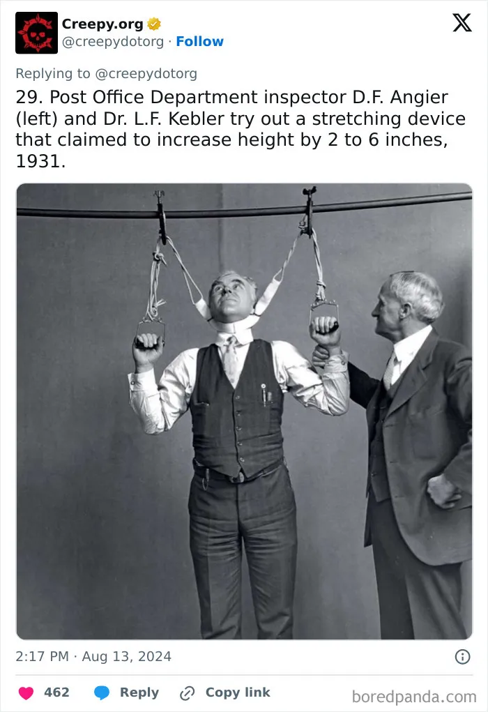 These 30 Bizarre Photos Show How Medical Treatments Were Carried Out Throughout History