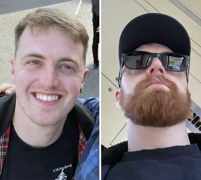 From Thinking I Couldn’t Grow A Full Beard To This Ginger Mess