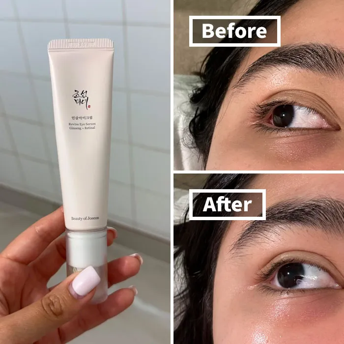 <a Style="Display:inline;" Href="Https://Www.amazon.com/Beauty-Joseon-Revive-Eye-Serum/Dp/B0b45ll4dd?dib=eyj2ijoimsj9.gzs3i_bq6jr7hlgqgykggot3wsi0m3thrmxcifhxdwabqm6wkmo4xbbbydffby8xsmxsdte1iugbrlinikgp8kj1sqflybufbdify4lx-S54qwpjlrqdfsjqpb9b4asxqjuv9uxvamse8n4vnhz3_tlo6g6if3eesuvfohsriay.ivx6w-D2agvramj1k78hsnt3ysqzftbizqpjx2apdfm&dib_tag=se&qid=1723012168&sr=8-55&srs=97786221011&th=1&linkcode=ll1&tag=bpgorilla-20&linkid=614beb00c135872b9d1b745689d7ba21&language=en_us&ref_=as_li_ss_tl" Target="_blank"><span Style="Font: Inherit; Color: #d74b1f;"> Beauty Of Joseon Revive Eye Serum</Span> Is The Gentle Yet Powerful Potion That Will Awaken Your Tired Eyes, Banishing Dark Circles And Puffiness Like A Refreshing Breeze From The Korean Countryside