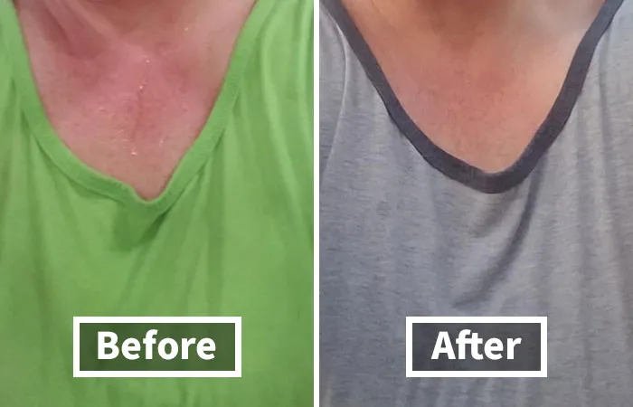 Sweaty Palms Making Handshakes Awkward? Wipe Away The Worry With These   <a Style="Display:inline;" Href="Https://Www.amazon.com/Sweatblock-Antiperspirant-Clinical-Strength-Reduce/Dp/B002pq8bqm?ie=utf8&linkcode=ll1&tag=bpfish-20&linkid=c7e908102c7b1a8d9d177b706d326d7c&language=en_us&ref_=as_li_ss_tl " Target="_blank"><span Style="Font: Inherit; Color: #d74b1f;"> Sweatblock Max Clinical Antiperspirant Wipes</Span> - Your Handshake Will Be Firm And Dry, Just Like Your Confidence