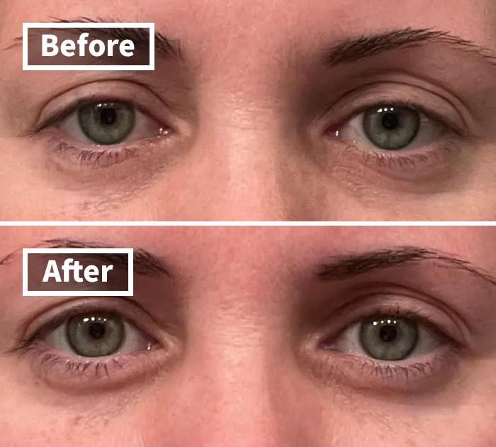 Late Nights Got Your Eyes Looking Like You've Been Crying Over Spilled Milk?    <a Style="Display:inline;" Href="Https://Www.amazon.com/CeraVe-Repair-Cream-Circles-Puffiness/Dp/B00jjpmxdo?ie=utf8&linkcode=ll1&tag=bpfish-20&linkid=e6e960264d2ce02ef9954c62726a57a9&language=en_us&ref_=as_li_ss_tl " Target="_blank"><span Style="Font: Inherit; Color: #d74b1f;"> CeraVe Eye Repair Cream</Span> Will Have You Looking Bright-Eyed And Bushy-Tailed In No Tim
