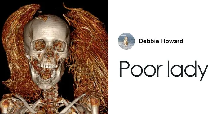 “So Horrible”: Virtual Autopsy Reveals Ancient Egyptian Mummy’s Heart-Wrenching Secret