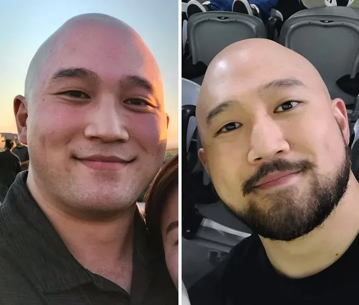 Without Or With Beard? Need Your Opinions