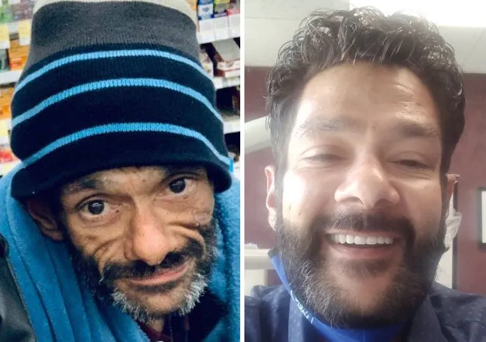 Now He Has Over 200 Days Sober And A Brand New Smile