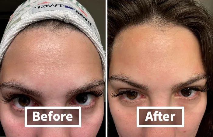 These   <a Style="Display:inline;" Href="Https://Www.amazon.com/Frownies-Forehead-Between-Eyes-Patches/Dp/B00027dmsi?psc=1&linkcode=ll1&tag=bpscorpion-20&linkid=e5e3b7754db57cb158a800c639935e9d&language=en_us&ref_=as_li_ss_tl " Target="_blank"><span Style="Font: Inherit; Color: #d74b1f;"> Wrinkle Patches</Span> Will Have You Looking More 'Zen' Than 'Mean'