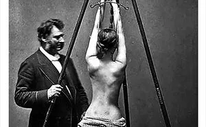 These 30 Bizarre Photos Show How Medical Treatments Were Carried Out Throughout History