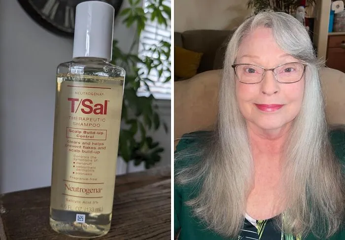 Flaky Scalp Got You Feeling Like A Snow Globe? This <a Style="Display:inline;" Href="Https://Www.amazon.com/Neutrogena-Therapeutic-Salicylic-Seborrheic-Dermatitis/Dp/B00uol93cg?ie=utf8&linkcode=ll1&tag=bpelephant-20&linkid=d4d0b703945bc902102d175c2fe81c9b&language=en_us&ref_=as_li_ss_tl" Target="_blank"><a Style="Display:inline;" Href="Https://Www.amazon.com/Neutrogena-Therapeutic-Salicylic-Seborrheic-Dermatitis/Dp/B00uol93cg?ie=utf8&linkcode=ll1&tag=bpelephant-20&linkid=d4d0b703945bc902102d175c2fe81c9b&language=en_us&ref_=as_li_ss_tl" Target="_blank"><span Style="Font: Inherit; Color: #d74b1f;"> Therapeutic Shampoo With Salicylic Acid</Span> Will Clear Things Up Faster Than A Blizzard Warning