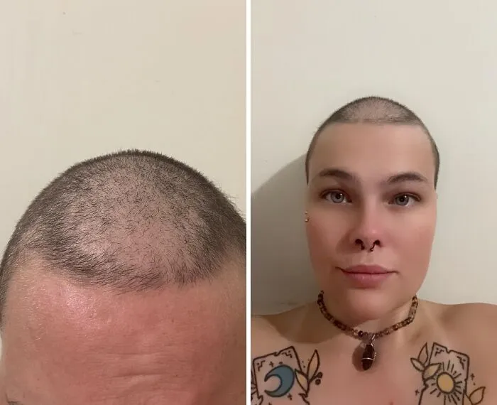 "Decided to shave my head to give it a fresh start, turns out I have a bald spot. I’m female " - <span Style="Font:inherit;color:#808080"> mookaroo</Span>