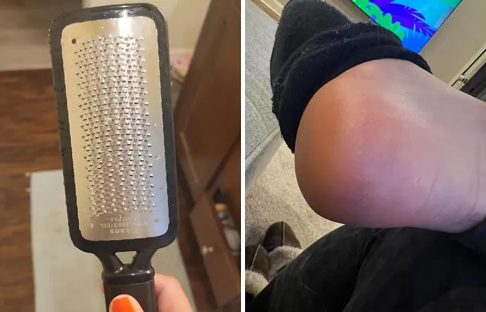 This <a Style="Display:inline;" Href="Https://Www.amazon.com/Colossal-Remover-Pedicure-Surgical-Stainless/Dp/B00vpvevsk?ie=utf8&linkcode=ll1&tag=bpsnail-20&linkid=99cb93a1ade75bc428405d1106f082d3&language=en_us&ref_=as_li_ss_tl" Target="_blank"><span Style="Font: Inherit; Color: #d74b1f;"> Colossal Foot Rasp</Span> Will Turn Your Calluses Into Dust 