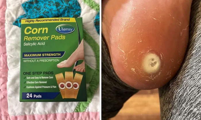 Your Feet Are About To Have A Cinderella Moment With These <a Style="Display:inline;" Href="Https://Www.amazon.com/Remover-Corn-Toe-Corn-Callus-Removal-Large/Dp/B081cms2yh?ie=utf8&linkcode=ll1&tag=bpsnail-20&linkid=33b6c25c81027c9efc726b7568641400&language=en_us&ref_=as_li_ss_tl" Target="_blank"><span Style="Font: Inherit; Color: #d74b1f;"> Corn Removers</Span> 