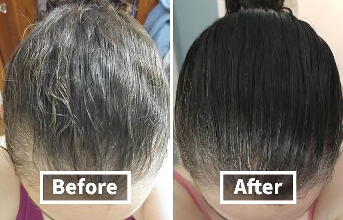 Thinning Hair Got You Feeling A Little Less Rapunzel, A Little More Friar Tuck?  This <a Style="Display:inline;" Href="Https://Www.amazon.com/Biotin-Hair-Shampoo-Thinning-Moisturizing/Dp/B01encboa0?ie=utf8&linkcode=ll1&tag=bpsnail-20&linkid=5760d43b4fc7b8c40bc91cef33495225&language=en_us&ref_=as_li_ss_tl" Target="_blank"><span Style="Font: Inherit; Color: #d74b1f;"> Rosemary And Biotin Shampoo</Span> Might Just Be Your Hair's Knight In Shining Armor