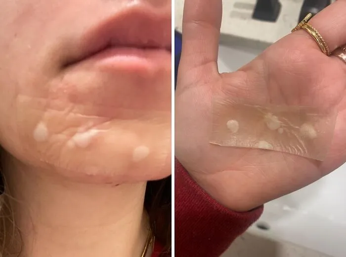 Pimple Emergency? This <a Style="Display:inline;" Href="Https://Www.amazon.com/Mighty-Patch-Surface-Best-Selling-Hydrocolloid/Dp/B07kjxfjhf?ie=utf8&linkcode=ll1&tag=bpsnail-20&linkid=2cd085e6c163f871cc53198020a0ba54&language=en_us&ref_=as_li_ss_tl" Target="_blank"><span Style="Font: Inherit; Color: #d74b1f;"> Mighty Patch</Span> Is Your Undercover Agent For Overnight Zit Zapping