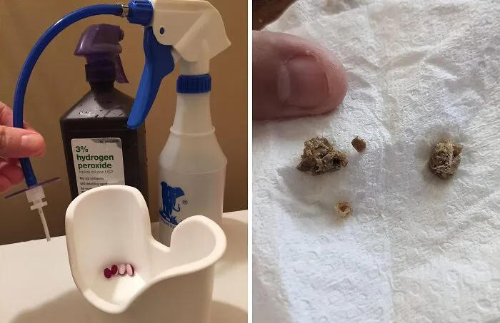 Ear Wax Feeling A Bit Dumbo-Sized? This <a Style="Display:inline;" Href="Https://Www.amazon.com/Elephant-Washer-Bottle-Doctor-Easy/Dp/B005m2b5p0?ie=utf8&linkcode=ll1&tag=bpsnail-20&linkid=e4ecefb1abca41a2ba8a896ec7bd11e3&language=en_us&ref_=as_li_ss_tl" Target="_blank"><span Style="Font: Inherit; Color: #d74b1f;"> Ear Washer Bottle System</Span> Will Have Them Squeaky Clean Without A Trip To The Doctor
