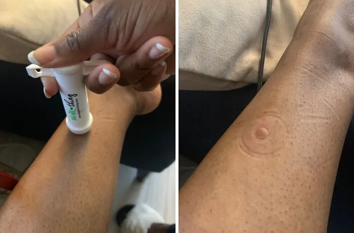 This <a Style="Display:inline;" Href="Https://Www.amazon.com/Bite-Thing-Suction-Poison-Remover/Dp/B08pfcmgbf?dib=eyj2ijoimsj9.pdl3bja7i35-Mxxs7usaxn624frc7oyfpgwa6cd7_8sk6xma7nytxebup5lkocqfflwn0j0z6ptbooqlnkiwe68bpcoeiarizkfnsvjt1aizdkqsxsrvqtrdtzmsa3bxrzkgezlrxbrhsbk8ql0koqsdb8x-Yzxibmk1ervr1wficjmyvo1dmcpat8hdpvufqt5s-Etrrgzaztbadq9t-Ezmyuldlbrncxxwxceah42rtp6x2_owddxkjr1auzvpvvlamwfca0eompvfvrwanq6ypiyt5fmtk13rldzoila.5qi0i_rthqpjykgqzka3k2nrigz1ghrz0pvubclu-Q8&dib_tag=se&keywords=shark%2btank%2bproducts&qid=1725577299&sr=8-7&th=1&linkcode=ll1&tag=bpturtle-20&linkid=fa13182bf70071f4fe276a990769cb62&language=en_us&ref_=as_li_ss_tl" Target="_blank"><span Style="Font: Inherit; Color: #d74b1f;"> Bug Bite Thing Suction Tool</Span> Will Have You Saying "Bite Me" To Those Pesky Mosquitoes