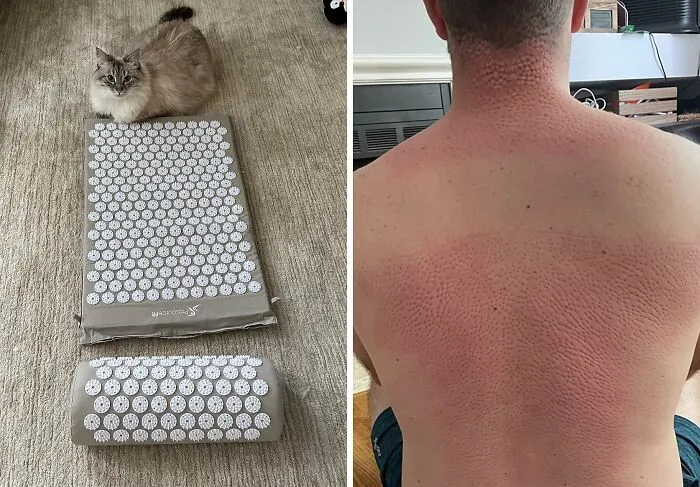 This <a Style="Display:inline;" Href="Https://Www.amazon.com/Prosource-Acupressure-Pillow-Relief-Relaxation/Dp/B00i1qcpik?dib=eyj2ijoimsj9.pdl3bja7i35-Mxxs7usaxn624frc7oyfpgwa6cd7_8sk6xma7nytxebup5lkocqfflwn0j0z6ptbooqlnkiwe68bpcoeiarizkfnsvjt1aizdkqsxsrvqtrdtzmsa3bxrzkgezlrxbrhsbk8ql0koqsdb8x-Yzxibmk1ervr1wficjmyvo1dmcpat8hdpvufqt5s-Etrrgzaztbadq9t-Ezmyuldlbrncxxwxceah42rtp6x2_owddxkjr1auzvpvvlamwfca0eompvfvrwanq6ypiyt5fmtk13rldzoila.5qi0i_rthqpjykgqzka3k2nrigz1ghrz0pvubclu-Q8&dib_tag=se&keywords=shark%2btank%2bproducts&qid=1725577299&sr=8-9&th=1&linkcode=ll1&tag=bpturtle-20&linkid=4bb5bfb18801b8b690173674efee864d&language=en_us&ref_=as_li_ss_tl" Target="_blank"><span Style="Font: Inherit; Color: #d74b1f;"> Acupressure Mat And Pillow Set</Span> Will Have You Saying "Namaste" To Pain Relief And "Goodbye" To Muscle Tension