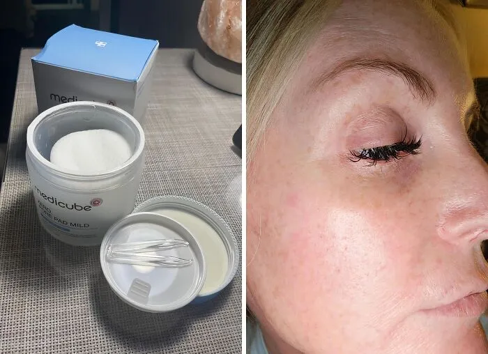 If You're Looking For A Pore-Fect Complexion, Look No Further Than These <a Style="Display:inline;" Href="Https://Www.amazon.com/Medicube-Super-Cica-Pad-Certified/Dp/B09v7z4tjg?th=1&linkcode=ll1&tag=bppig-20&linkid=5cf18e6adc6c6dfeae98462e6c4b8037&language=en_us&ref_=as_li_ss_tl" Target="_blank"><span Style="Font: Inherit; Color: #d74b1f;"> Medicube Zero Pore Pads</Span>
