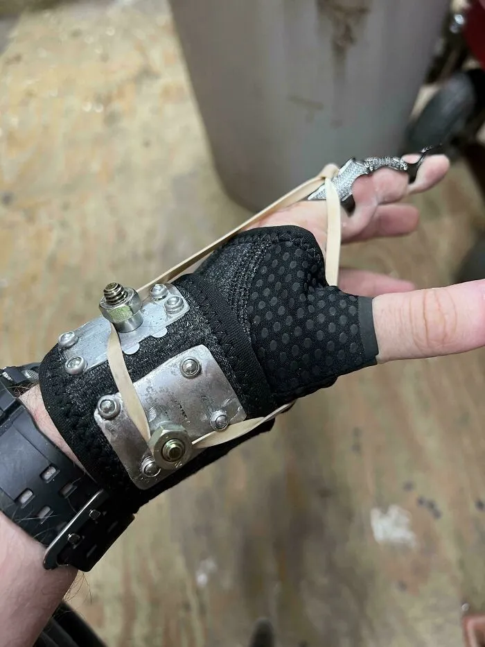 Me corté un nervio y perdí un tercio de la movilidad del dedo. Esta prótesis del estilo Frankenstein que hicimos con mi padre me ayuda con la recuperación