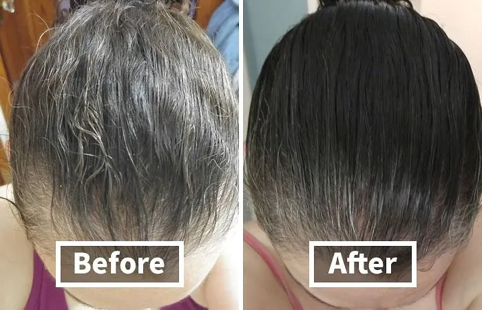 Boost Your Hair Care Routine With <a Style="Display:inline;" Href=" Https://Www.amazon.com/Biotin-Hair-Shampoo-Thinning-Moisturizing/Dp/B01encboa0?ie=utf8&linkcode=ll1&tag=bpbee-20&linkid=e98ef2499327e0e6087e771ef22dd59d&language=en_us&ref_=as_li_ss_tl " Target="_blank"> <span Style="Font: Inherit; Color: #d74b1f;"> Biotin Shampoo</Span> For Thinning Hair: Helps Strengthen And Nourish For Fuller, Healthier Locks
