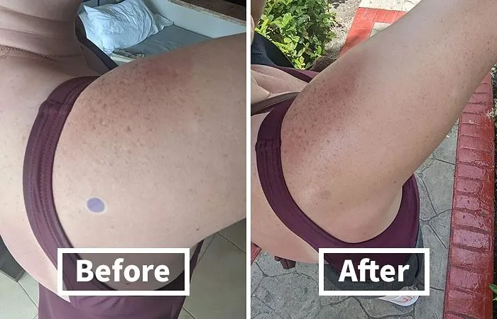 Sun's Out, Fun's Out, But These <a Style="Display:inline;" Href="Https://Www.amazon.com/Spotmyuv-Stickers-Sunscreen-Dermatrue-Technology/Dp/B08x6w1tzj?ie=utf8&linkcode=ll1&tag=bpcobra-20&linkid=10bebcc41a8563eab8fcc67134db7c4f&language=en_us&ref_=as_li_ss_tl" Target="_blank"><span Style="Font: Inherit; Color: #d74b1f;"> Sunscreen Detection Stickers</Span> Will Keep The Burn Out