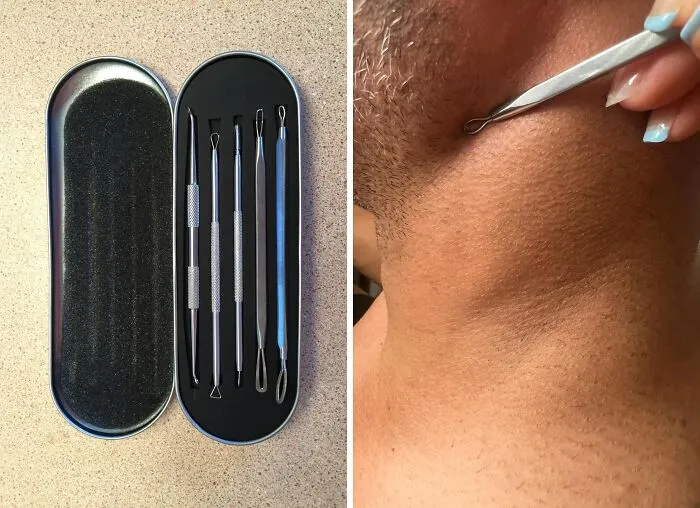 This <a Style="Display:inline;" Href="Https://Www.amazon.com/Bestope-Blackhead-Remover-Comedone-Extractor/Dp/B019svhley?ie=utf8&linkcode=ll1&tag=bpgnu-20&linkid=044a2063de3144b0347b4bea813ba95b&language=en_us&ref_=as_li_ss_tl" Target="_blank"><span Style="Font: Inherit; Color: #d74b1f;"> Blackhead Remover Tool</Span> Is So Satisfying To Use, You Might Just Find Yourself Looking For Blackheads You Didn't Even Know You Had