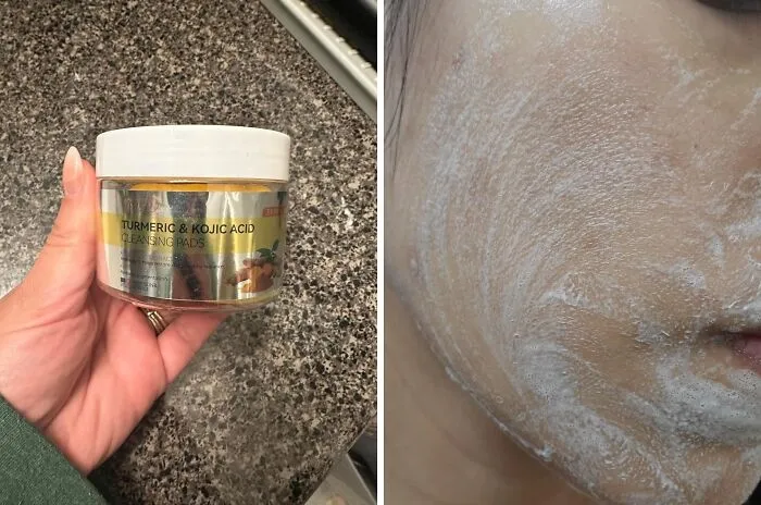 <a Style="Display:inline;" Href=" Https://Www.amazon.com/Kojic-Acid-Turmeric-Cleansing-Exfoliation/Dp/B0d91jd4w5?pd_rd_w=gl09i&content-ID=amzn1.sym.7379aab7-0dd8-4729-B0b5-2074f1cb413d&pf_rd_p=7379aab7-0dd8-4729-B0b5-2074f1cb413d&pf_rd_r=fz6gjqsrvk6dn0nhybad&pd_rd_wg=cxfax&pd_rd_r=f3caf047-E731-4a94-Bbeb-6549e65b5eac&pd_rd_i=b0d91jd4w5&psc=1&linkcode=ll1&tag=bpmoose-20&linkid=bbf75c9600afab4ab5aa1c5d2edd5b6d&language=en_us&ref_=as_li_ss_tl  " Target="_blank"><span Style="Font:inherit;color:#d74b1f;"> Turmeric Cleansing Pads</Span>? Heck Yeah, Welcome To That Glow Life