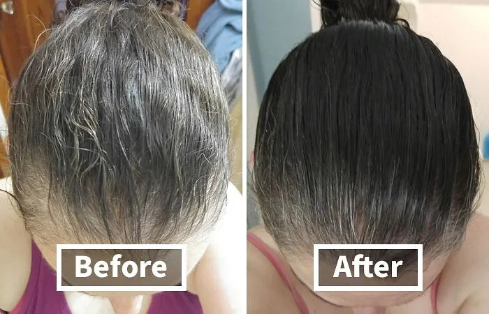 <a Style="Display:inline;" Href="Https://Www.amazon.com/Biotin-Hair-Shampoo-Thinning-Moisturizing/Dp/B01encboa0?ie=utf8&linkcode=ll1&tag=bpgnu-20&linkid=ff8322baa52d6d1829d57532ff4afbd5&language=en_us&ref_=as_li_ss_tl" Target="_blank"><span Style="Font: Inherit; Color: #d74b1f;"> Rosemary And Biotin Shampoo</Span> Will Give Your Locks The TLC They Deserve
