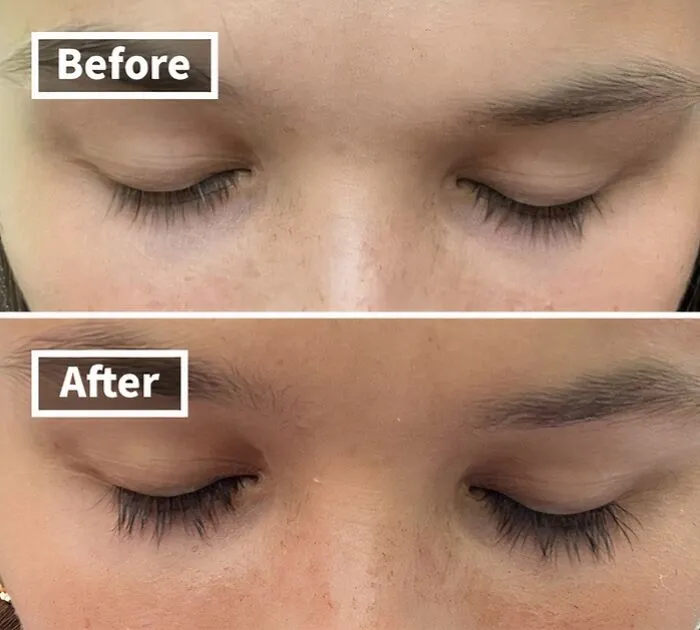 Lashes So Long, They'll Have Their Own Zip Code!  This   <a Style="Display:inline;" Href="Https://Www.amazon.com/Dp/B07bkv4b6q?psc=1&pd_rd_i=b07bkv4b6q&pd_rd_w=ohgyw&content-ID=amzn1.sym.8c2f9165-8e93-42a1-8313-73d3809141a2&pf_rd_p=8c2f9165-8e93-42a1-8313-73d3809141a2&pf_rd_r=f46p10fxj5sw1zde1nqg&pd_rd_wg=oj4cw&pd_rd_r=9d02bf52-294a-4933-B2e0-66ac20e27ee1&s=beauty&sp_csd=d2lkz2v0tmftzt1zcf9kzxrhaww&linkcode=ll1&tag=bpmole-20&linkid=2be6e2a7845784404e0a8599af211d73&language=en_us&ref_=as_li_ss_tl" Target="_blank"><span Style="Font: Inherit; Color: #d74b1f;"> Eyelash Serum</Span> Is The Secret To Fluttery, Fabulous Lashes