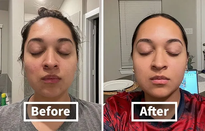 Don't Let Breakouts Steal Your Spotlight! This   <a Style="Display:inline;" Href="Https://Www.amazon.com/Dp/B07vrfc3y7?ascsubtag=7701154%2c12%2c36%2cd%2c0%2c0%2c0%2c900%3a2%3b974%3a3%3b1125%3a1%3b1338%3a1%2c48149606%2c0%2c0%2c0&btn_ref=srctok-D4ee845e50f58196&linkcode=ll1&tag=bpmole-20&linkid=a7c0ab35cc4f2b1426dee3ea556b1e8c&language=en_us&ref_=as_li_ss_tl" Target="_blank"><span Style="Font: Inherit; Color: #d74b1f;"> Skinsmart Facial Cleanser</Span> Is The Hidden Gem That Will Have Your Skin Glowing Brighter Than A Disco Ball