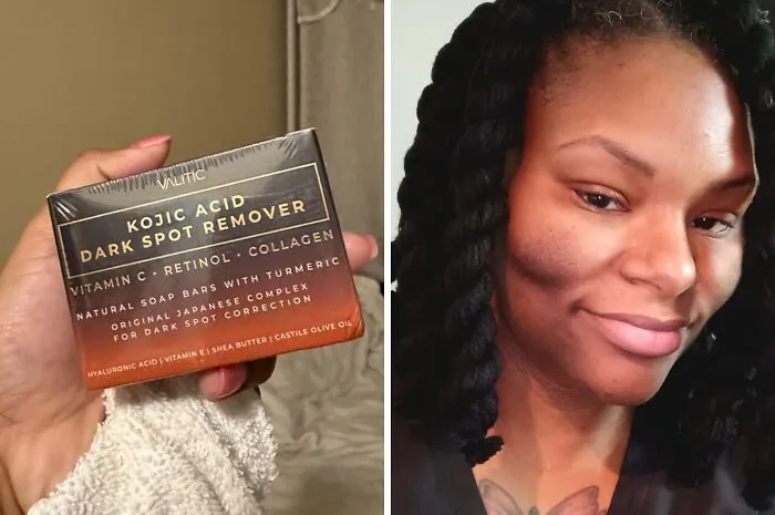 Sunspots And Dark Marks Got You Feeling Shady? This <a Style="Display:inline;" Href="Https://Www.amazon.com/Valitic-Remover-Vitamin-Collagen-Turmeric/Dp/B09mfmctrk?ie=utf8&linkcode=ll1&tag=bpkomodo-20&linkid=e9b94f926f4655577c56f0258e1b124b&language=en_us&ref_=as_li_ss_tl " Target="_blank"><span Style="Font: Inherit; Color: #d74b1f;"> Kojic Acid Soap</Span> Will Brighten Things Up And Leave Your Skin Glowing